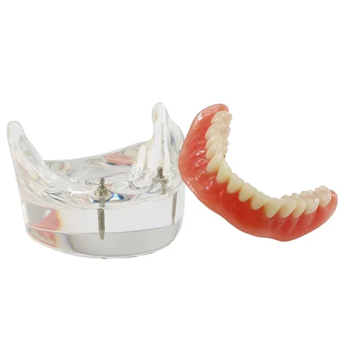 Vista 15 de Multifarious Tipos Modelo Dental Dientes Removibles Implante Ortodoncia Enseñanza Estudiar Modelos de demostración para Dentista Estudiante Escuela