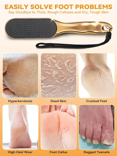 Vista 5 de Beyond The Cream Veins - Lima de pie de grano de nano, removedor de callos de piel dura, herramienta de pedicura profesional, cuerda de mango