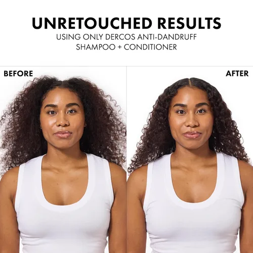 Vista 2 de Dercos Dandruff Shampoo, Antifungal Dry Scalp Treatment & Itchy Scalp Relief, Prescription Strength Selenium Sulfide Comparable to 2% Ketoconazole