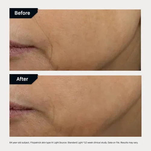 Vista 6 de Revision Skincare D·E·J Face Cream®, Advanced Anti Aging Moisturizer, Lifting and Firming, Antioxidant Rich